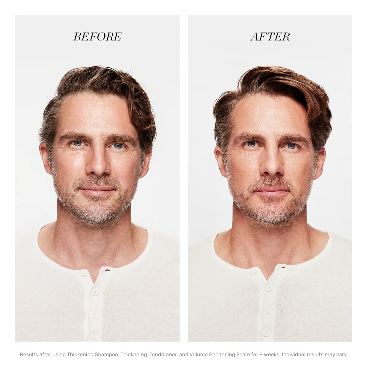 REVITALASH® HAIR MAKEOVER SET