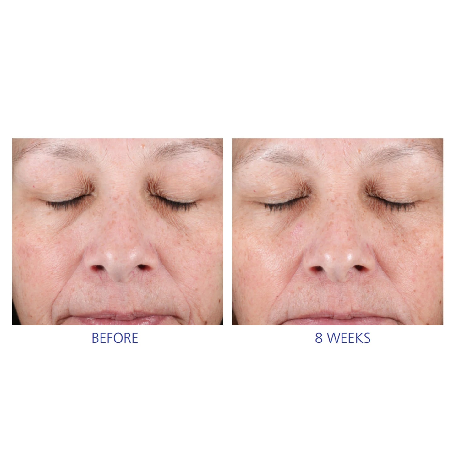 iS Clinical - Active Peel System